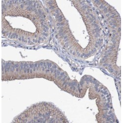 Endothelial Protein C Receptor (EPCR) Antibody