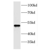 WB analysis of human spleen tissue, using PROCR antibody (1/400 dilution).