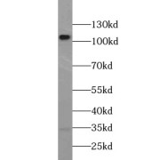 WB analysis of HeLa cells, using EPHB4 antibody (1/1000 dilution).