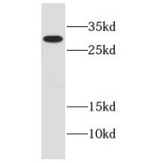 WB analysis of human brain tissue, using EFNA3 antibody (1/400 dilution).