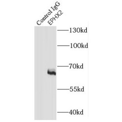 Epoxide Hydrolase 2, Cytoplasmic (EPHX2) Antibody