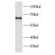 WB analysis of HeLa cells, using EPHX2 antibody (1/1000 dilution).