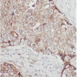 Epidermal Growth Factor Receptor Pathway Substrate 8 (EPS8) Antibody