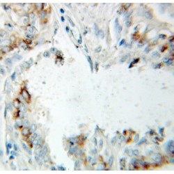 Endoplasmic Reticulum-Associated Amyloid Beta-Peptide-Binding Protein (ERAB) Antibody