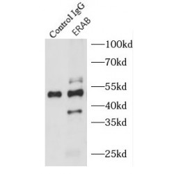 Endoplasmic Reticulum-Associated Amyloid Beta-Peptide-Binding Protein (ERAB) Antibody