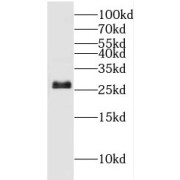 WB analysis of HeLa cells, using HSD17B10 antibody (1/1000 dilution).