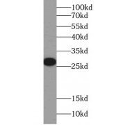 WB analysis of HEK-293 cells, using ERAB antibody (1/2000 dilution).