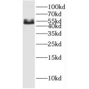 WB analysis of Jurkat cells, using ERAL1 antibody (1/1000 dilution).