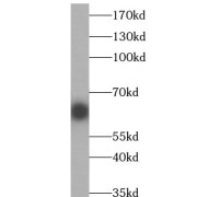 WB analysis of A549 cells, using ERAP2 antibody (1/500 dilution).