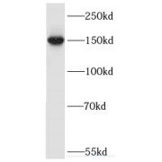 WB analysis of mouse brain tissue, using ERCC6/CSB antibody (1/500 dilution).