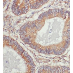 Endoplasmic Reticulum-Golgi Intermediate Compartment (ERGIC) 1 (ERGIC1) Antibody