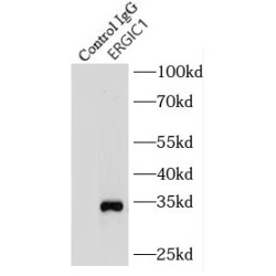 Endoplasmic Reticulum-Golgi Intermediate Compartment (ERGIC) 1 (ERGIC1) Antibody