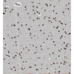 Enhancer of Rudimentary Homolog (Drosophila) (ERH) Antibody