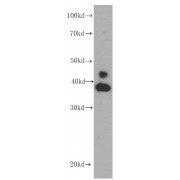 WB analysis of HeLa cells, using ERK1/2 antibody (1/1000 dilution).