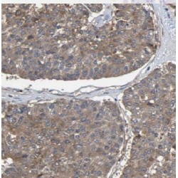 ERO1-Like Beta (S. Cerevisiae) (ERO1LB) Antibody