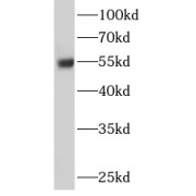 WB analysis of HeLa cells, using ERO1LB antibody (1/500 dilution).