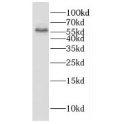 WB analysis of human lung tissue, using ESAM antibody (1/500 dilution).