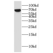 WB analysis of HeLa cells, using ESCO2 antibody (1/1000 dilution).