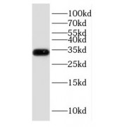 WB analysis of K-562 cells, using ESD antibody (1/1000 dilution).