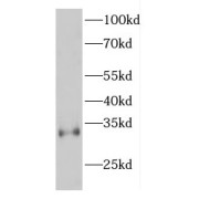 WB analysis of mouse brain tissue, using ESPN antibody (1/200 dilution).