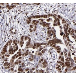 Estrogen Receptor Beta (ESR2) Antibody