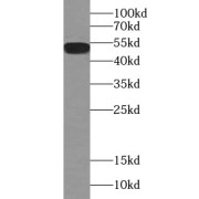 WB analysis of PC-3 cells, using ESR2 antibody (1/1000 dilution).