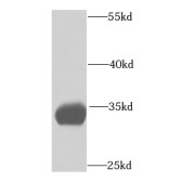 WB analysis of mouse small intestine tissue, using ETFA antibody (1/1000 dilution).