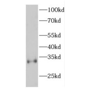 WB analysis of mouse skeletal muscle tissue, using ETFB antibody (1/1000 dilution).