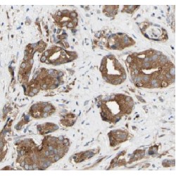 Electron Transferring Flavoprotein Dehydrogenase (ETFDH) Antibody