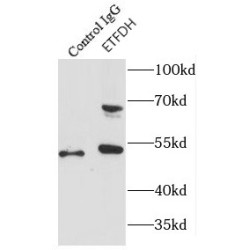 Electron Transferring Flavoprotein Dehydrogenase (ETFDH) Antibody