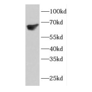 WB analysis of mouse brain tissue, using ETFDH antibody (1/1000 dilution).