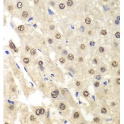 Protein C-Ets-1 (ETS1) Antibody