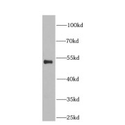 WB analysis of Jurkat cells, using ETS1 antibody (1/1000 dilution).