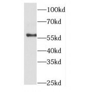 WB analysis of PC-3 cells, using ETV5 antibody (1/500 dilution).