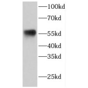 WB analysis of A431 cells, using ETV6 antibody (1/1000 dilution).