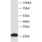 WB analysis of human brain tissue, using EVI2A antibody (1/300 dilution).