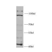 WB analysis of Jurkat cells, using EXO1 antibody (1/1000 dilution).