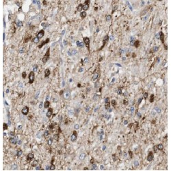 Exocyst Complex Component 1 (EXOC1) Antibody