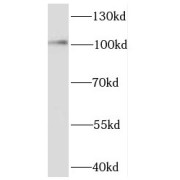 WB analysis of rat brain tissue, using EXOC1 antibody (1/1000 dilution).