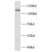 WB analysis of human testis tissue, using EXOC6 antibody (1/300 dilution).