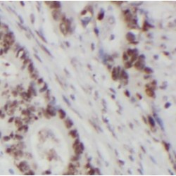 Exosome Component 2 (EXOSC2) Antibody