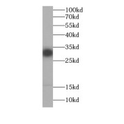 WB analysis of Jurkat cells, using EXOSC2 antibody (1/1000 dilution).