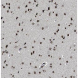 Exosome Component 4 (EXOSC4) Antibody