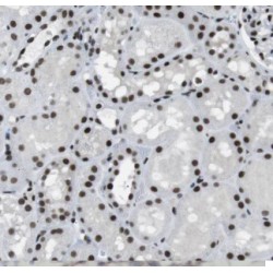 Eyes Absent Homolog 1 (EYA1) Antibody