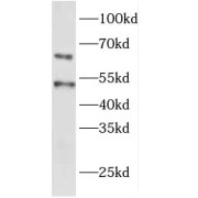 WB analysis of mouse kidney tissue, using EYA1 antibody (1/600 dilution).