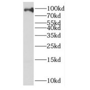 WB analysis of HL-60 cells, using EZH1 antibody (1/1000 dilution).