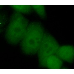 Histone-Lysine N-Methyltransferase EZH2 (EZH2) Antibody