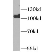 WB analysis of HT-29 cells, using EZH2 antibody (1/2000 dilution).