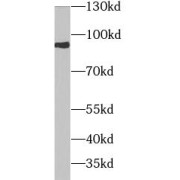 WB analysis of 293T cells, using Ezrin antibody (1/1000 dilution).