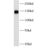 WB analysis of mouse liver tissue, using F5 antibody (1/1000 dilution).